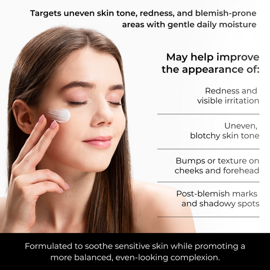Azelaic Acid Cream